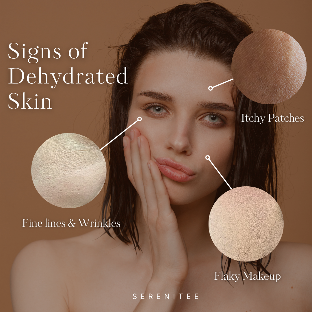 A woman with dehydrated skin showing signs like itchy patches, fine lines, wrinkles, and flaky makeup. Sponges are shown above her face.