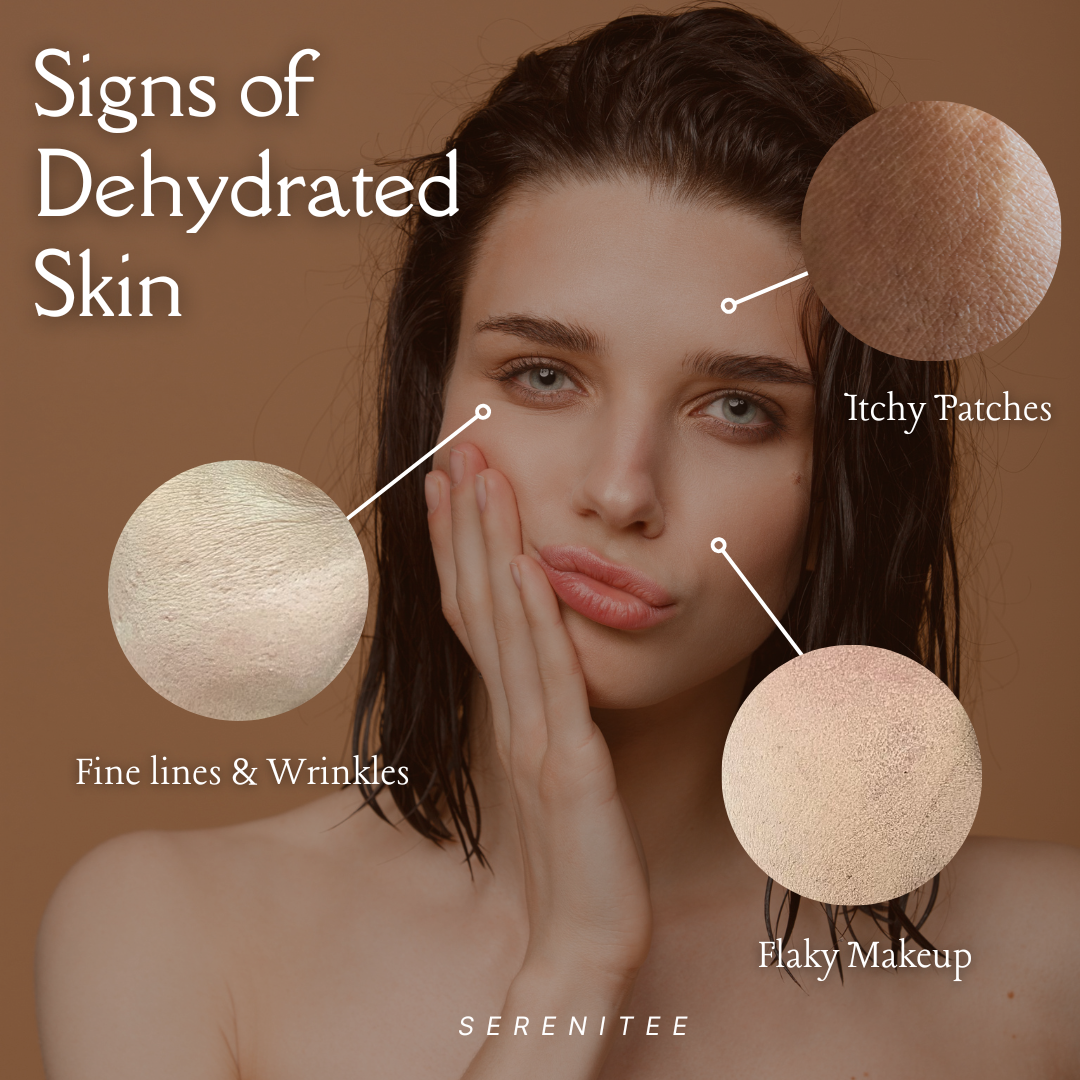 Woman with dehydrated skin showing signs like fine lines, flaky makeup, and itchy patches on a brown background.