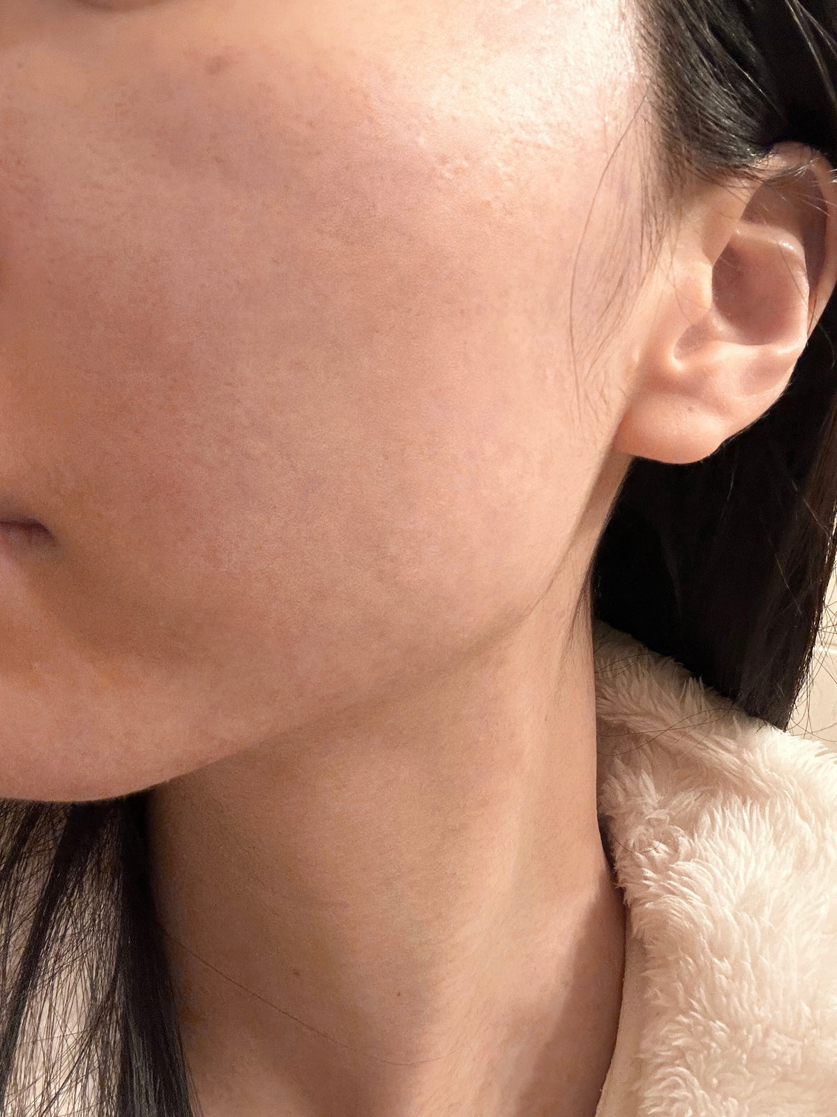 After-use close-up showing calmer-looking cheek with less visible redness.
