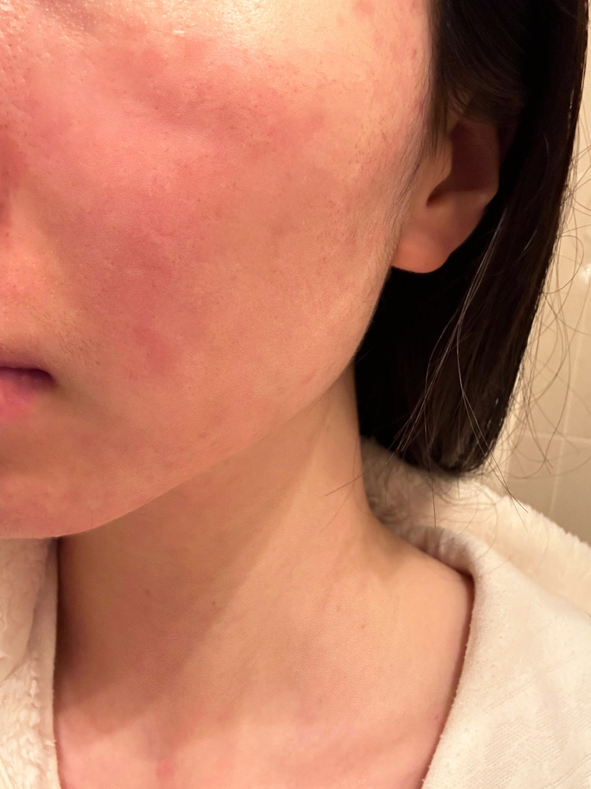 Before-use close-up showing visible cheek redness and uneven skin texture.