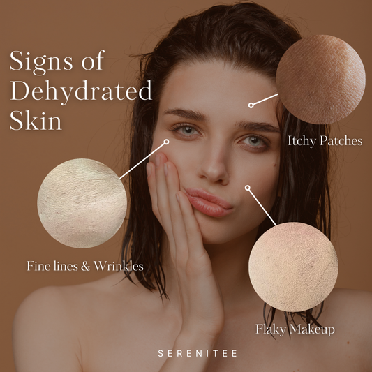 A woman with dehydrated skin showing signs like itchy patches, fine lines, wrinkles, and flaky makeup. Sponges are shown above her face.